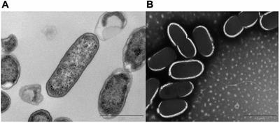 Petrophilic, Fe(III) Reducing Exoelectrogen Citrobacter sp. KVM11, Isolated From Hydrocarbon Fed Microbial Electrochemical Remediation Systems